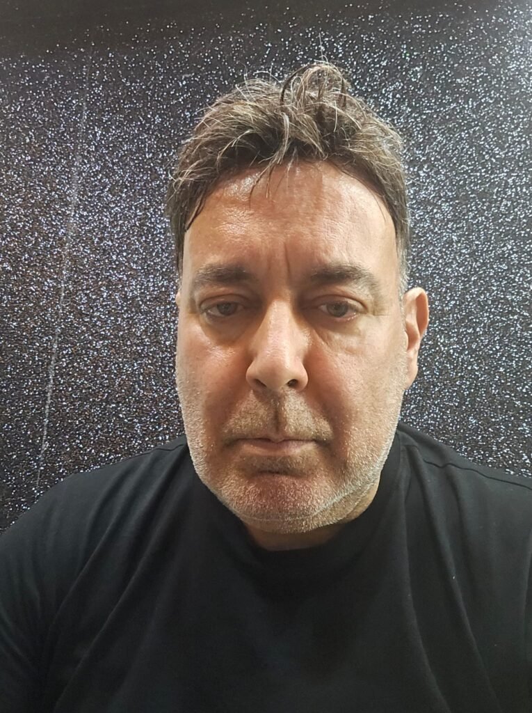 Kanal Tedavisi Sonrası Ağrı: Ne Kadar Sürer, Ne Zaman Doktora Gidilir? 1 Dr. Cüneyt Bosna Ankara Kızılay diş hekimi