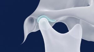 Makaleler 24 Çene eklemi (TME) anatomisi